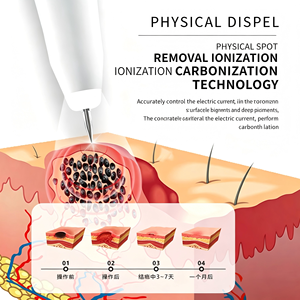 15-Level Electric Skin Tag Remover <b>Pen</b> for Mole, Wart, Freckle and Spot Removal at Home or Salon - Product Image 6
