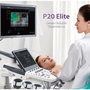 Ultrassom Colorido de Alta Frequência Sonoscape P20 Elite Tipo Carrinho para Exame Pré-Natal e Exclusão de Malformações Fetais - Product Image 6