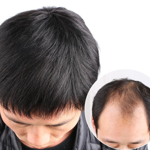 Fronte <span class=keywords><strong>da</strong></span> <span class=keywords><strong>uomo</strong></span> M-type linea di perdita di <span class=keywords><strong>capelli</strong></span> parrucca Patch pezzo di ricambio blocco di <span class=keywords><strong>capelli</strong></span> cuoio capelluto biologico parrucca di <span class=keywords><strong>capelli</strong></span> <span class=keywords><strong>veri</strong></span> frangia maschile - Product Image 5