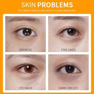 Crème pour les yeux raffermissante, éclaircissante, anti-cernes, enrichie en vitamine C, certifiée Halal, OEM ODM - Product Image 4