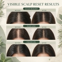HALORINNA Rosemary Mint Scalp Scrub 100g Pembersih Kulit Kepala Eksfoliasi untuk Rambut Berminyak OEM ODM Label Pribadi Perawatan Rambut