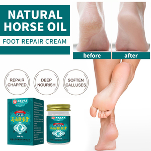 Crème pour les fissures à l'huile de <span class=keywords><strong>cheval</strong></span>, sécheresse des mains et des talons, saignements, crème hydratante et <span class=keywords><strong>cicatrisante</strong></span> douce - Product Image 4