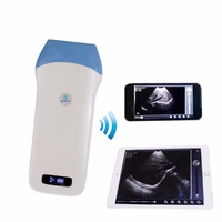 Uprobe-5L SUNORO Mini Scanner à ultrasons sans fil 3,5 MHz avec sonde convexe 128 éléments, compatible PC/téléphone pour usage vétérinaire