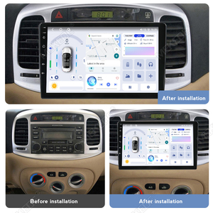 MEKEDE X30 X40 Car-play <span class=keywords><strong>Android</strong></span> Auto UIS7865 8 Çekirdekli Radyo Dokunmatik Ekran Multimedya Oynatıcısı Hyundai <span class=keywords><strong>Accent</strong></span> 2006-2011 için - Product Image 2