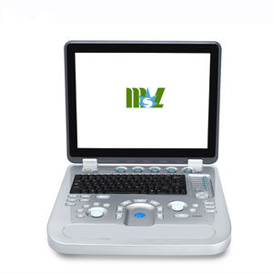 Mesin <span class=keywords><strong>Ultrasound</strong></span> Pemindai <span class=keywords><strong>Ultrasound</strong></span> Doppler Warna MSLCU17 - Product Image 2