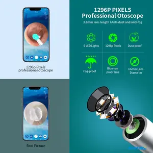 Nouveau produit : Nettoyeur d'oreilles sans fil durable avec caméra électrique et otoscope, facile à utiliser - Product Image 4