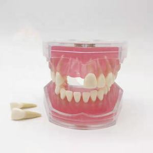 โมเดลฟันปลอมสำหรับการสอนแบบมาตรฐาน,โมเดลถอนฟันสำหรับนักเรียนแพทย์ - Product Image 4