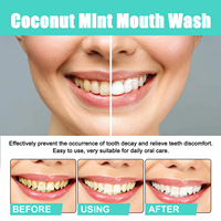 Enjuague Bucal OEM de Coco y Menta con Mentol y Raspador de Lengua, Sin Alcohol, 100 ml, Blanqueador Dental, Antiséptico, Aliento Fresco, Encías Saludables