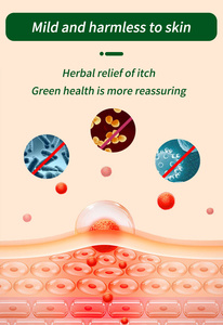 OEM/ODM chinesische pflanzliche Psoriasis-Dermatitis-Creme Haut-Ekzem Lokaler Juckreiz Anti-Pruritis-Sauft - Product Image 4