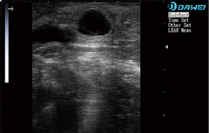 Ecógrafo Veterinario Dawei para Bovinos, Precio de Ecógrafo para Ovejas, Ecógrafo para Diagnóstico de Gestación en Vacas - Product Image 6