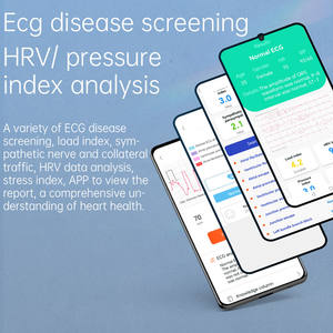 Nuevo Reloj Inteligente Internacional con Llamadas Bluetooth, Monitoreo del Sueño, ECG, SOS, Monitoreo de Presión Arterial y Seguimiento de Actividad Física - Product Image 3