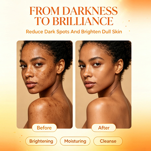 Ensemble de produits naturels et biologiques pour le visage en gros : Élimine les taches brunes, éclaircit la peau, illumine le teint, ensemble blanchissant à la carotte - Product Image 4