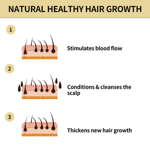 Private Label olio per la crescita dei capelli al rosmarino biologico naturale trattamento per la ricrescita dei capelli massaggio per la cura del cuoio capelluto olio per cuoio capelluto - Product Image 4