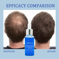 Private Label KUPFERPEPTID HAARWUCHSSERUM Kupferpeptid Hyaluronsäure Süßholzwurzelextrakt Ginsengwurzelextrakt Serum