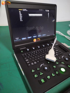 Mesin USG Digital Portabel SUN-800C untuk Kehamilan, Rumah Sakit, dan Ekokardiografi - Product Image 3