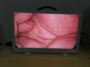 27 polegadas FHD Portátil Telepack Endoscópio Câmera Para Histeroscopia Laparoscopia Urologia - Product Image 4