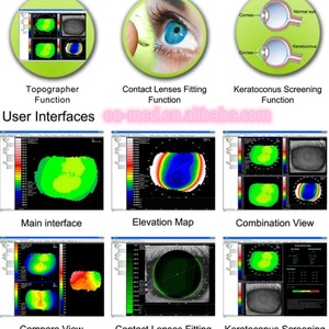 Topógrafo Corneal de Alto Rendimiento CTG6000, Medición, Obtención y Análisis de Datos de Refracción Corneal, Máquina Topográfica Corneal - Product Image 6