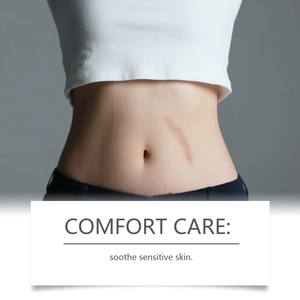 Nuevo Gel Corporal Refrescante de Textura Suave, al Mejor <span class=keywords><strong>Precio</strong></span> al por Mayor, que Elimina Cicatrices y <span class=keywords><strong>Estrías</strong></span> Fácil de usar. - Product Image 3