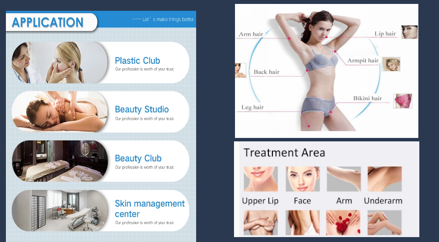 Super Nano Light OPT SHR IPL for hair removal/skin rejuvenation/Vascular Therapy & Breast lift