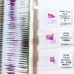 100 Pezzi di Vetrini per Microscopia Patologica Umana per l'Insegnamento - Product Image 3
