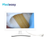 Moniteur d'entraînement endoscopique portable Medeasy 11 pouces, boîte de simulation d'entraînement, moniteur sans besoin de logiciel supplémentaire