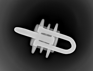 Kỹ Thuật Số X-Ray hệ thống máy dò cho deadend | nén deadend kiểm tra | hầu hết các cách trực tiếp để kiểm tra Giữa-span - Product Image 6