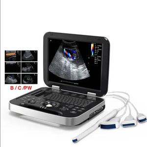 Échographie gynécologique d'ordinateur portable cardiaque d'échocardiographie médicale - Product Image 1