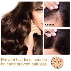 <b>Hair</b> Serum Anti-<b>hair</b> Loss Nourishing Fermented Rice Water Is Used for <b>Hair</b> Growth Treatment. - Product Image 3