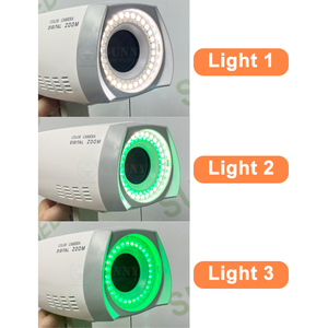 महिलाओं के लिए SY-F005-3 पोर्टेबल कोलेपोस्कोप अस्पताल हैंडहेल्ड कोलोस्कोप कैमरा - Product Image 6