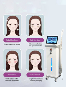 Máquina de Fotones Ultra-Micro BBL Nomei con 9 Filtros para Depilación, Pigmentación, Rejuvenecimiento Vascular y de la Piel, Equipo de Salón, OEM Disponible - Product Image 3