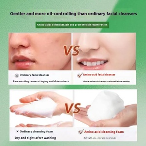 น้ำยาทำความสะอาดผิวหน้าสำหรับผู้หญิงโดยเฉพาะสำหรับการกำจัดสิวหัวดำทำให้รูขุมขนหดตัวเพิ่มความชุ่มชื้นและควบคุมความมัน - Product Image 5