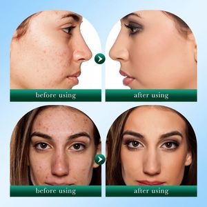 SADOER Detergente Viso Biologico Vegano Anti-Acne Good Morning Tea Tree Gel Cleanser 100g - Hot Sale Coreano per la Cura della Pelle OEM Private Label - Product Image 4