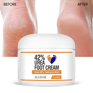 Eliminador de callos para el cuidado de los pies, crema Exfoliante para la piel muerta, ácido salicílico al 2%, crema para los pies de la Urea para la eliminación de piel muerta con tacones agrietados - Product Image 1