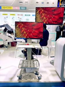 Ce Medische Videocamera Colposcoop Voor Gynaecologie Kernel Medische Apparatuur 4K Coloposcoop Vaginale Verjonging KN-2200IH - Product Image 6