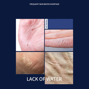 Crème pour les mains Li Xizi Vasline 80g True Moisture Intensive - Hydratante, nourrissante et réparatrice pour les pieds secs et gercés - Product Image 2