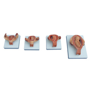 Metà a Grandezza naturale Sviluppo Del Feto Modello Anatomico Per modello di Insegnamento Medico - Product Image 2