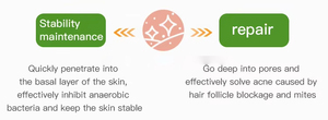 Perawatan jerawat bertenaga temukan Serum TERBAIK UNTUK kulit yang lebih jelas Serum Jerawat untuk sensitif menyingkirkan jerawat - Product Image 6