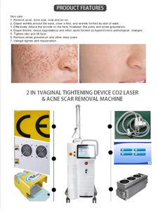 Appareil laser fractionnel CO2 pour l'élimination des cicatrices et le rajeunissement cutané, 10600 nm, usage commercial en salon, prix. - Product Image 6