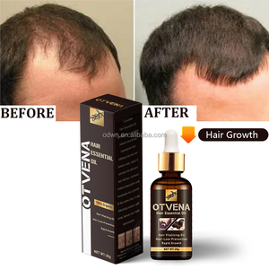 OTVENA Huile Capillaire Naturelle Anti-Chute Fortifiante et Lissante pour Cheveux Secs, Favorisant <span class=keywords><strong>la</strong></span> Croissance, Marque Privée, Vente en Gros - Product Image 1