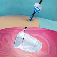 Chinese Manufacturer Disposable Laparoscopic Instruments 12mm Detachable Optical Trocar Kit