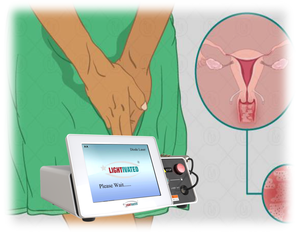 Máquina láser de diodo de 980nm y 1470nm para cirugía ginecológica Estiramiento vaginal cosmético - Product Image 4