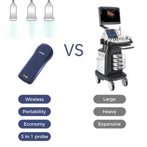 Mesin <span class=keywords><strong>Ultrasound</strong></span> Nirkabel Viatom C10 3 <span class=keywords><strong>in</strong></span> 1 Portabel Wifi Wireless Color Doppler <span class=keywords><strong>Ultrasound</strong></span> Probe - Product Image 4