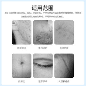 Gel cicatrisant médical en silicone OEM 20g pour brûlures, ébouillantements, chirurgie, réparation des cicatrices hypertrophiques post-partum - Product Image 2