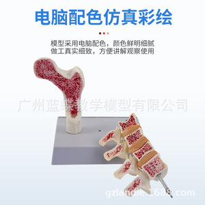 Modèle anatomique d'ostéoporose fémorale humaine, surface anatomique de l'os de la jambe, spécimen de section vertébrale, vertèbre lombaire malade - Product Image 5
