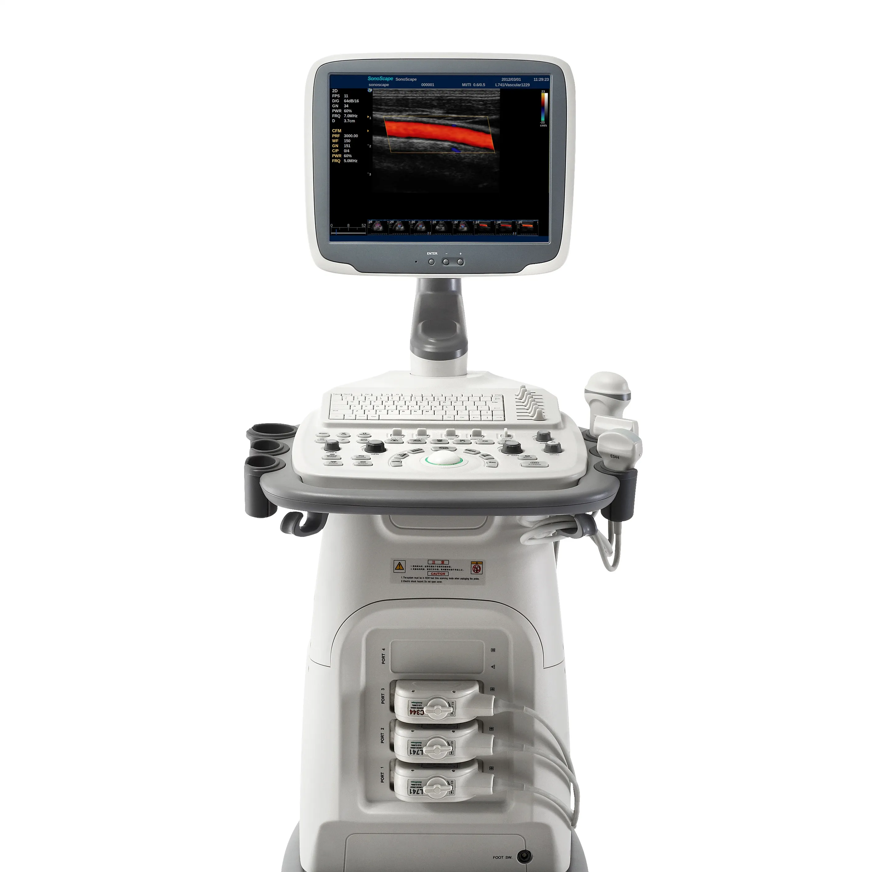 Trolley Ultrasound Machine 15 Inch Lcd 3D 4D Digitale Kleur Doppler Echografie Systeem S11