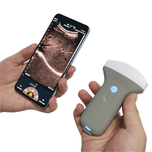 Escáner <span class=keywords><strong>de</strong></span> Ultrasonido <span class=keywords><strong>Doppler</strong></span> Color Inalámbrico Konted DYX10RL, Equipo Electrónico Óptico Portátil para Veterinaria - Product Image 2