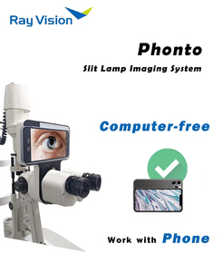 เครื่องมือตรวจวินิจฉัยโรคตาแบบสลิทแลมป์ ยี่ห้อ Manufacturer No PC Ophthalmic Instruments ระบบภาพถ่ายที่ใช้งานร่วมกับ IOS และ Android สำหรับการวินิจฉัยโรคตา - Product Image 4