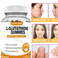 VitaSpring Gummies à la L-glutathione et Vitamine G pour l'éclaircissement de la peau, Compléments de beauté, Marque privée, Gummies à la Biotine et NAC, Gummies à la L-glutathione