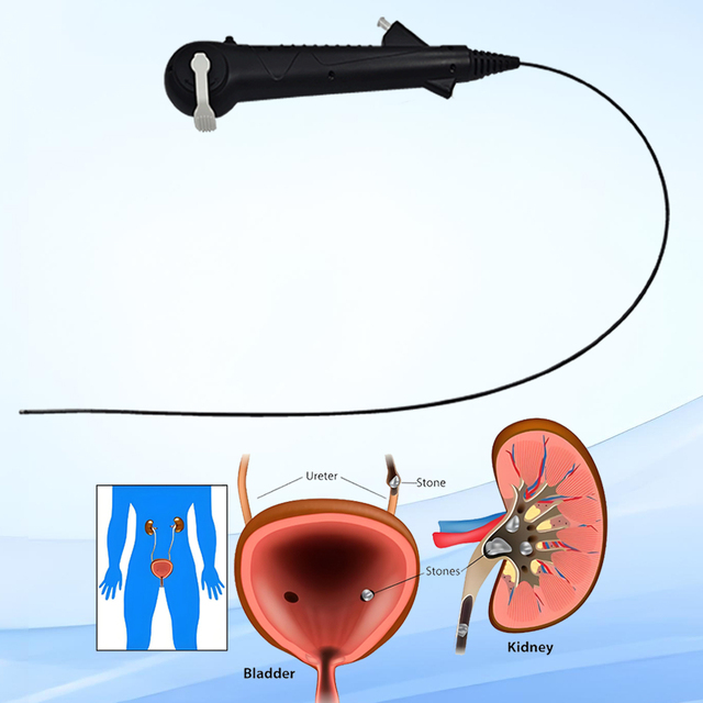 Medical Flexible Real Time High Image Durable Digital Surgical Endoscope 400*400 30fps Single-Use for Urology Use