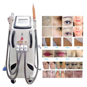 Appareil de beauté multifonctionnel 4 en 1 pour l'épilation, le rajeunissement de la peau, l'élimination des tatouages Yag et le lifting du visage - Product Image 4